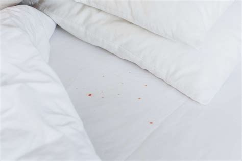 Bed bug stains. Things To Know About Bed bug stains. 